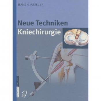 Neue Techniken Kniechirurgie