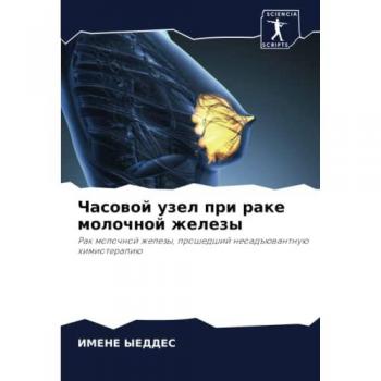 Часовой узел при раке молочной железы: Рак молочной железы, прошедший неоадъювантную химиотерапию: Rak molochnoj zhelezy, proshedshij neoad#üwantnuü himioterapiü