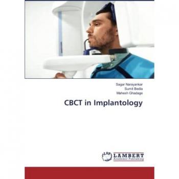 CBCT in Implantology: DE
