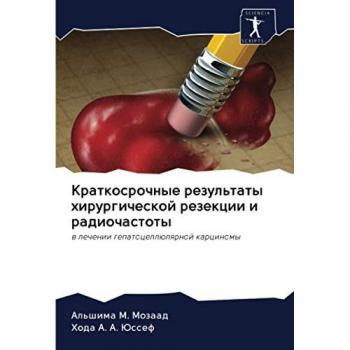 Краткосрочные результаты хирургической резекции и радиочастоты: в лечении гепатоцеллюлярной карциномы: w lechenii gepatocellülqrnoj karcinomy