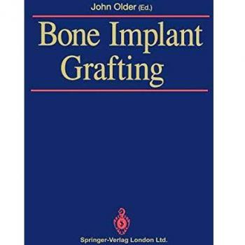 Bone Implant Grafting