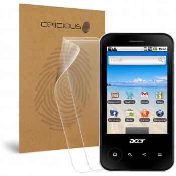 AntiGlare Defender Pack