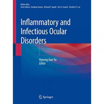 Inflammatory and Infectious Ocular Disorders