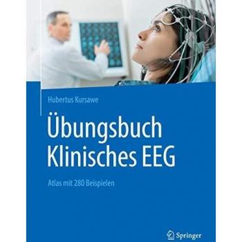 Übungsbuch Klinisches EEG