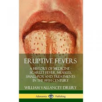 Eruptive Fevers