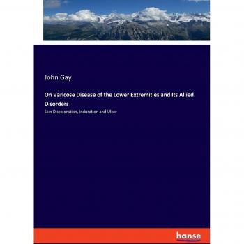 On Varicose Disease of the Lower Extremities and Its Allied Disorders: Skin Discoloration, Induration and Ulcer