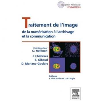 Traitement de l'image
