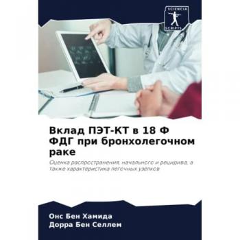 Вклад ПЭТ-КТ в 18 Ф ФДГ при бронхолегочном раке: Оценка распространения, начального и рецидива, а также характеристика легочных узелков: Ocenka 