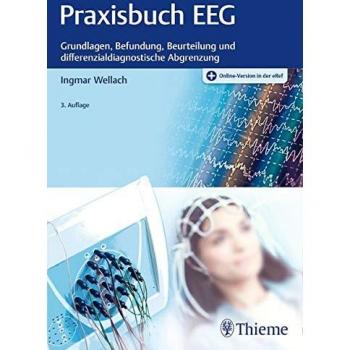 Ingmar Wellach Praxisbuch Eeg: Grundlagen, Befundung, Beurteilung Und Differenzialdiagnostische Abgrenzung
