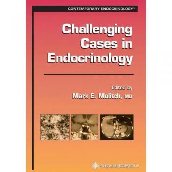 Challenging Cases in Endocrinology (Contemporary Endocrinology)