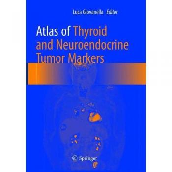 Atlas of Thyroid and Neuroendocrine Tumor Markers, Fachbücher von Luca Giovanella