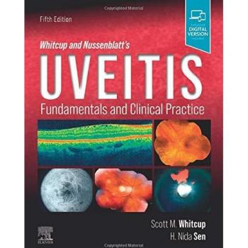 Scott M. Whitcup Whitcup and Nussenblatt's Uveitis