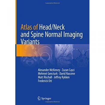 Mckinney, Alexander: Atlas of Head/Neck and Spine Normal Imaging Variants