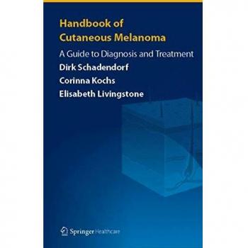 Handbook of Cutaneous Melanoma: A Guide to Diagnosis and Treatment