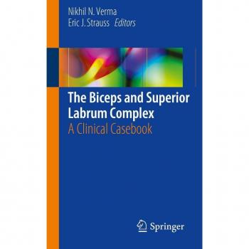 The Biceps and Superior Labrum Complex