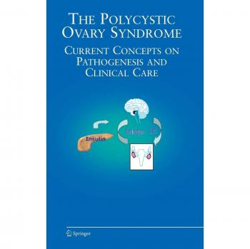 The Polycystic Ovary Syndrome
