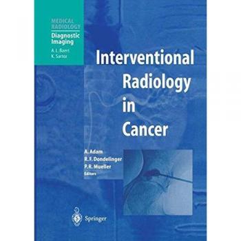 Interventional Radiology in Cancer (Medical Radiology)