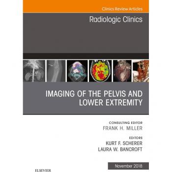 Vitalsource Technologies, Inc. Imaging of the Pelvis and Lower Extremity, An Issue of Radiologic Clinics of North America