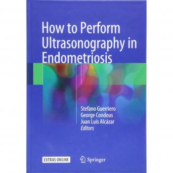 How to Perform Ultrasonography in Endometriosis