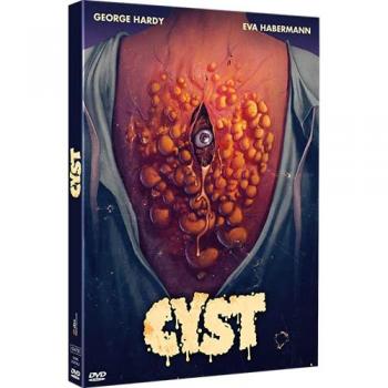 Cyste vidéo