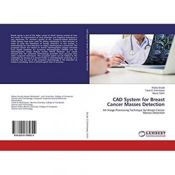 CAD System for Breast Cancer Masses Detection: An Image Processing Technique for Breast Cancer Masses Detection
