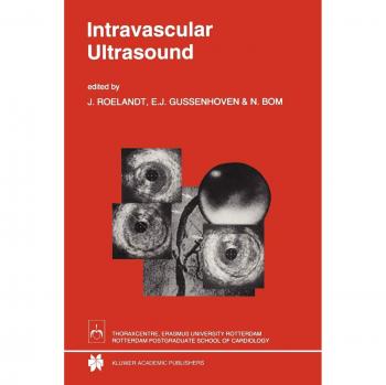 Intravascular Ultrasound