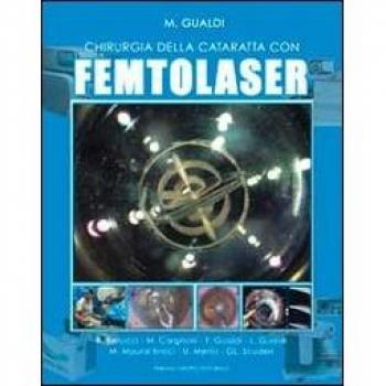 Chirurgia della cataratta con FEMTOLASER