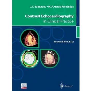 Contrast echocardiography in clinical practice