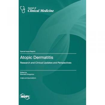 Atopic Dermatitis