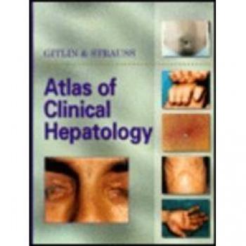 Atlas of Clinical Hepatology