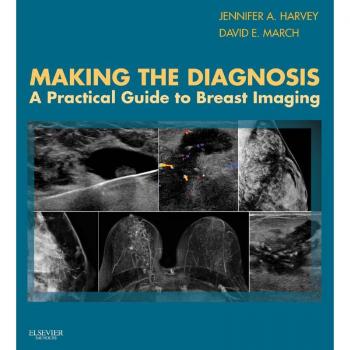Vitalsource Technologies, Inc. Making The Diagnosis: A Practical Guide To Breast Imaging E-book
