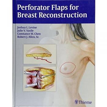 Perforator Flaps For Breast Reconstruction