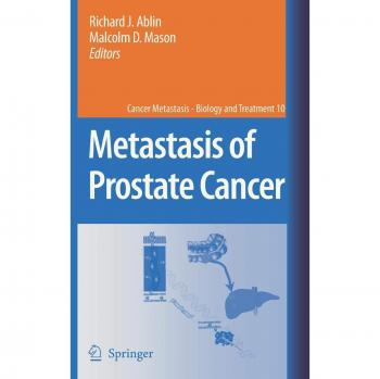 Metastasis of Prostate Cancer