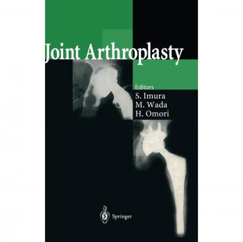 Joint Arthroplasty