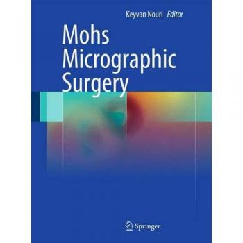 Mohs Micrographic Surgery