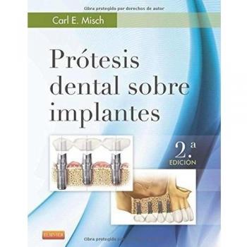 Prótesis dental sobre implantes