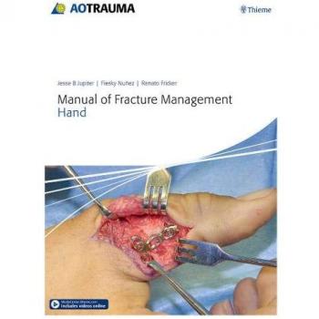 Manual Of Fracture Management