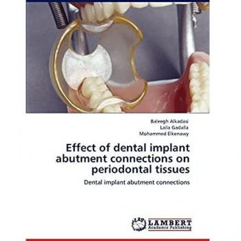 Effect of dental implant abutment connections on periodontal tissues