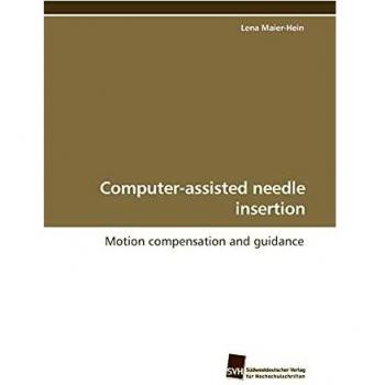 Computer-assisted needle insertion: Motion compensation and guidance