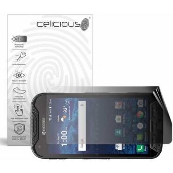 DuraShield Dual‑Perspective Privacy Screen