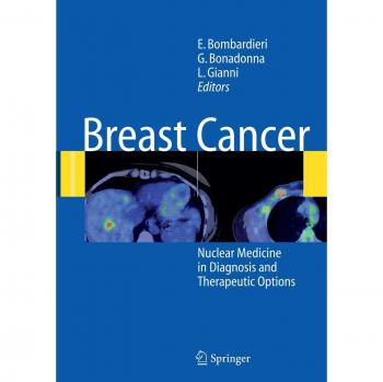 Breast Cancer: Nuclear Medicine in Diagnosis and Therapeutic Options