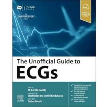 The Unofficial Guide to ECGs