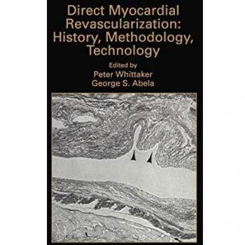 Direct Myocardial Revascularization, Developments in Cardiovascular Medicine