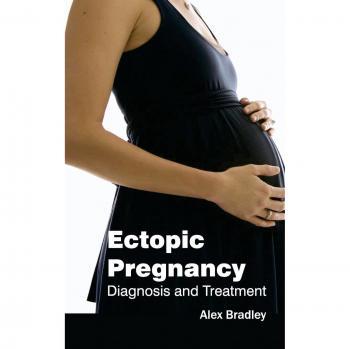 Ectopic Pregnancy