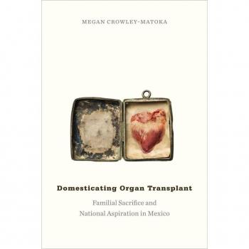 Domesticating Organ Transplant by Megan CrowleyMatoka