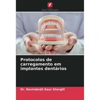 Protocolos de carregamento em implantes dentários