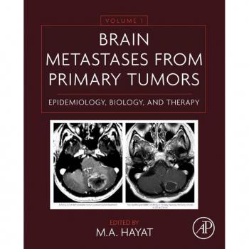 Brain Metastases from Primary Tumors Volume 1