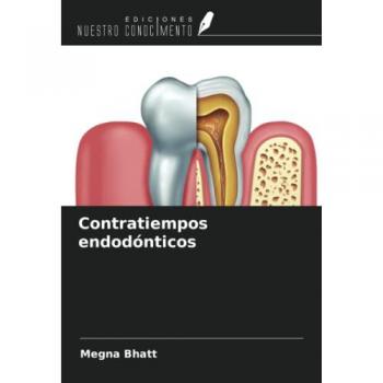 Contratiempos endodónticos