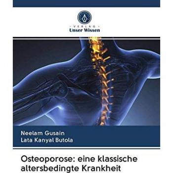 Osteoporose: eine klassische altersbedingte Krankheit