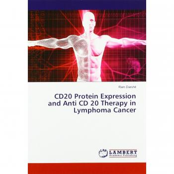 CD20 Protein Expression and Anti CD 20 Therapy in Lymphoma Cancer